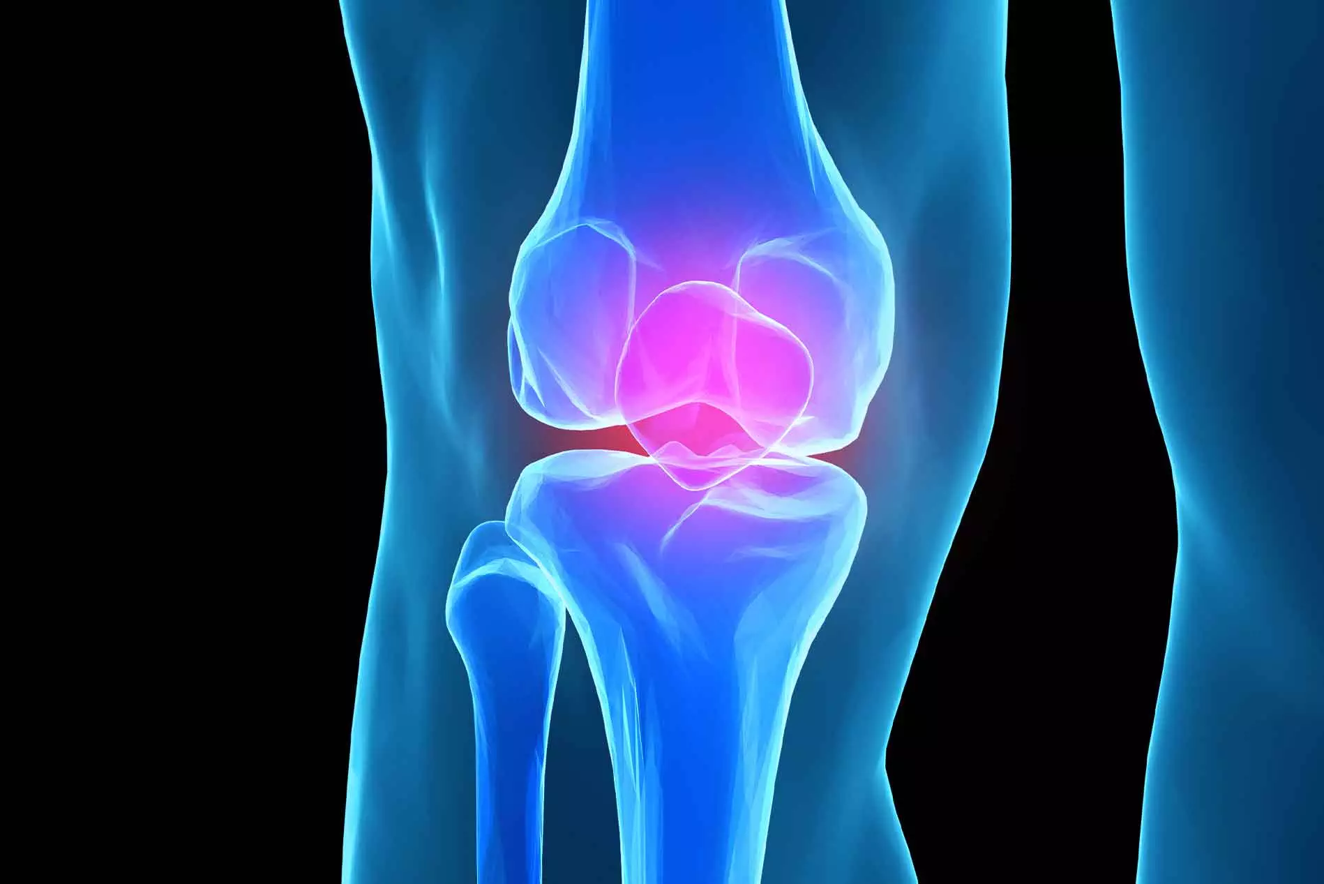 Knee Genicular Nerve Radiofrequency Treatment | Blackberry Clinic